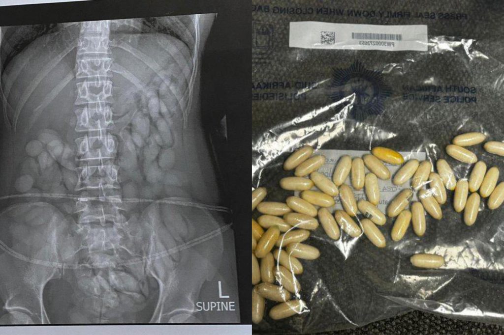 South African police report arrest of Namibian woman at airport with stomach full of drugs – National