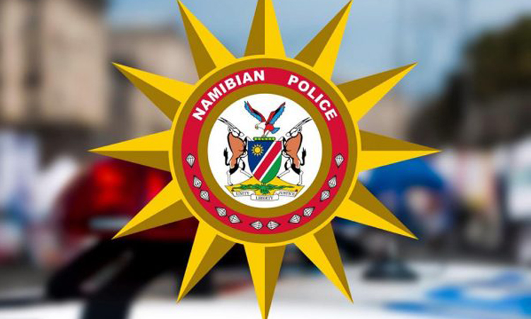 Oixuna yomunhu oi dule yombwa