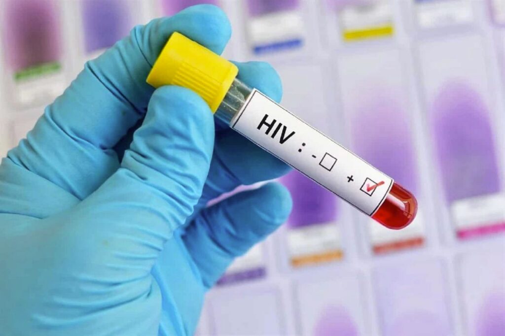 96% of Kavango East residents know their HIV status